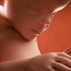 Feto de 27 semanas de embarazo